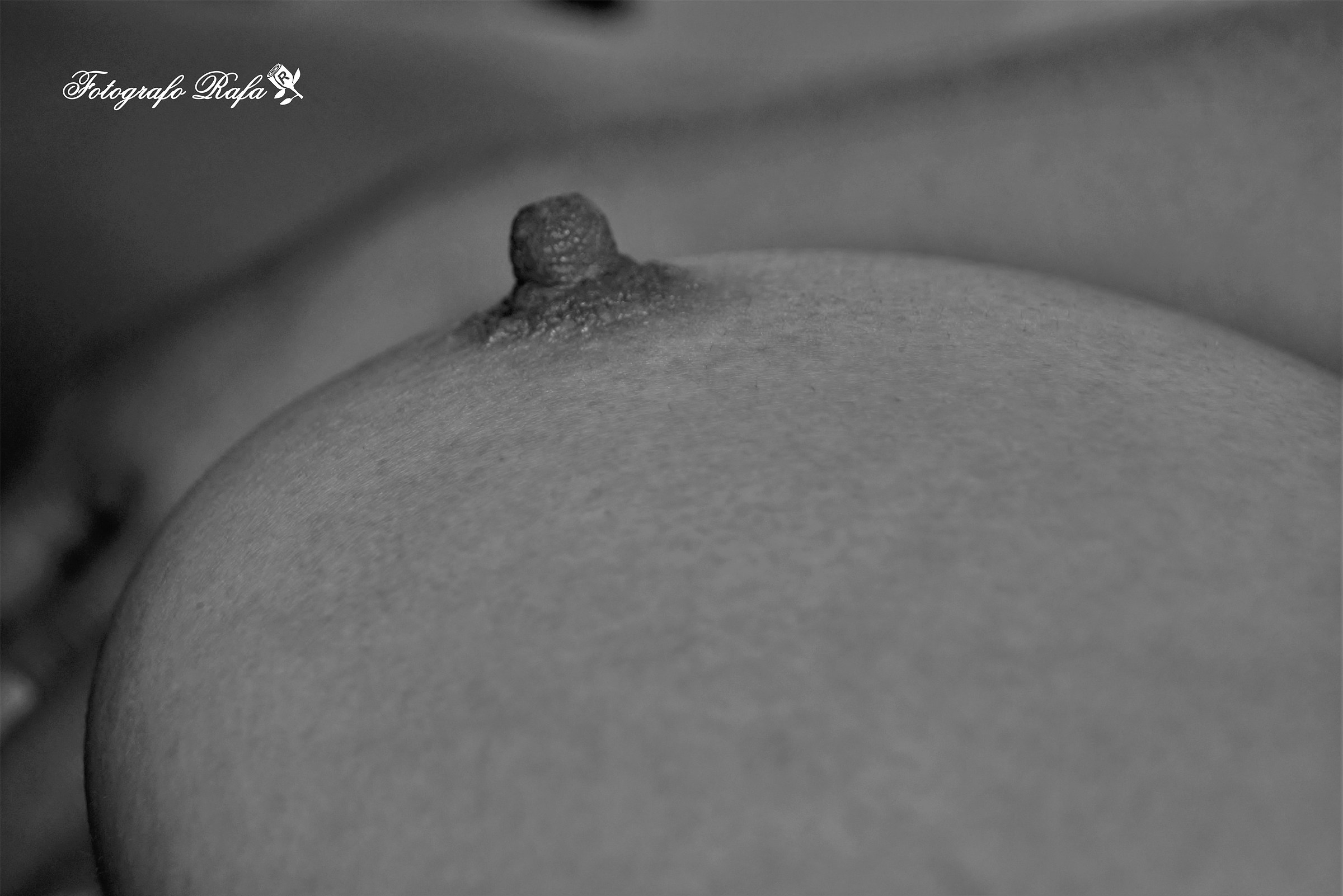 Breast...